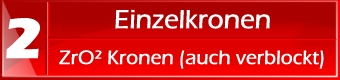 Auftragsvorbereitung - Einzelkronen verblockt