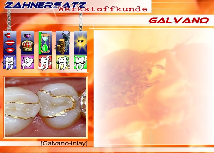 Galvano-Inlay