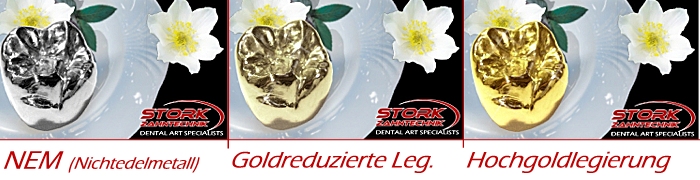 Vollgußkronen aus verschiedenen Werstoffen